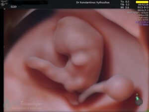 1η επίσκεψη 3d