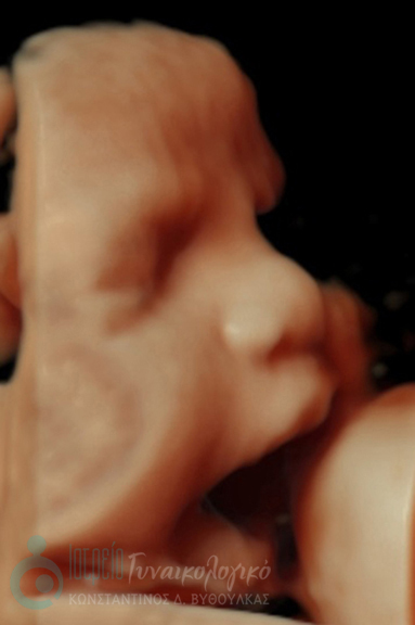 στόμα-ανοικτό-2